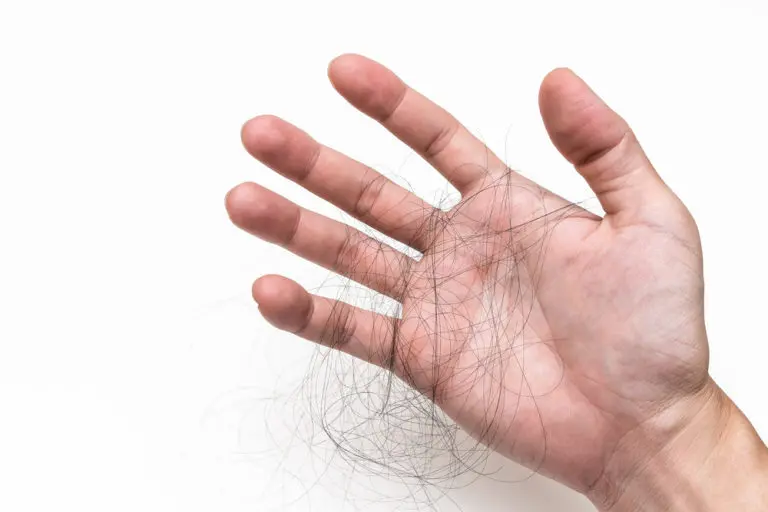 Top 6 Causes of Men’s Hair Loss