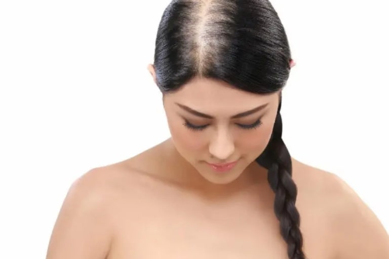 10 Hair Loss Prevention Tips For Women With Thinning Hair