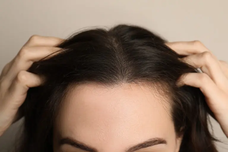 What You Need to Know About Hair Transplant for Women’s Hair Loss