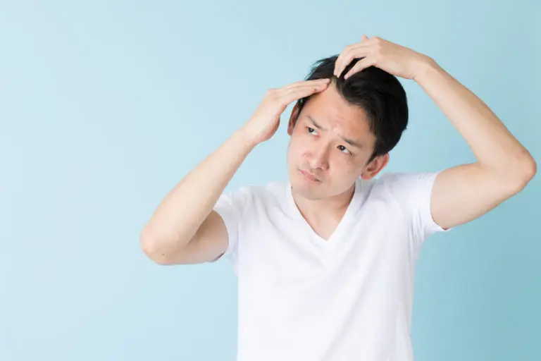 Signs of Thinning Hair for Males in Their 20s