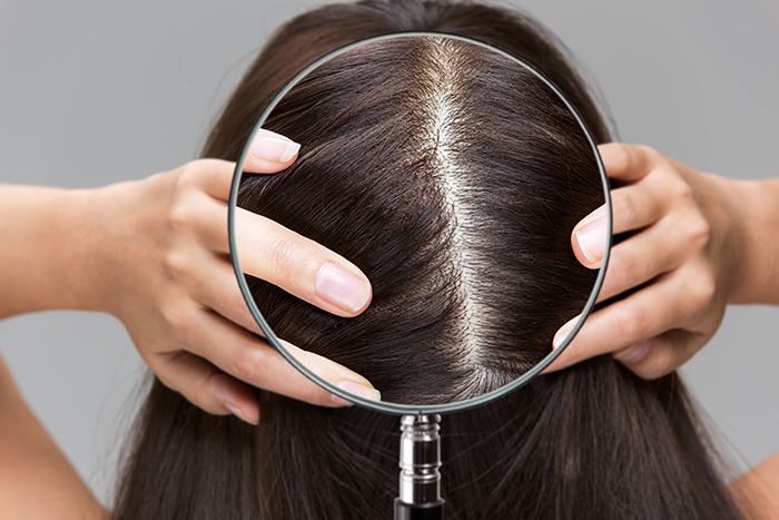 What Does an Unhealthy Scalp Look Like, and How Can You Fix It?