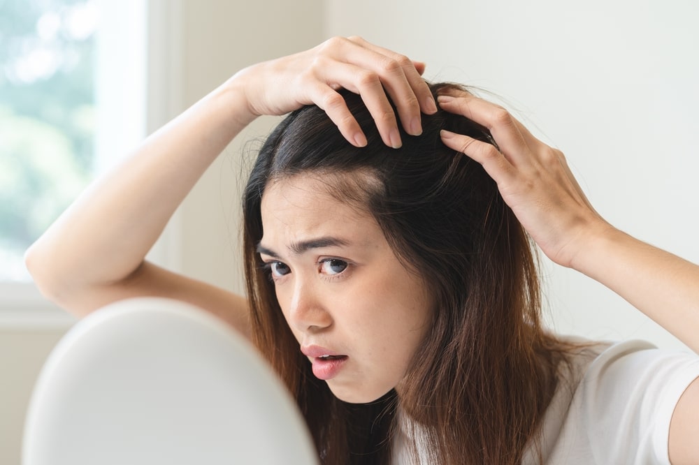 Addressing Androgenetic Alopecia in Women: Its Causes and Treatments