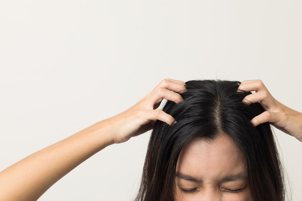 11 Ways to Treat Your Itchy Scalp
