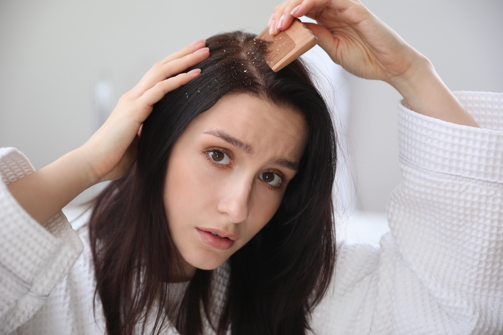 Quick Tips: How to Prevent Dandruff