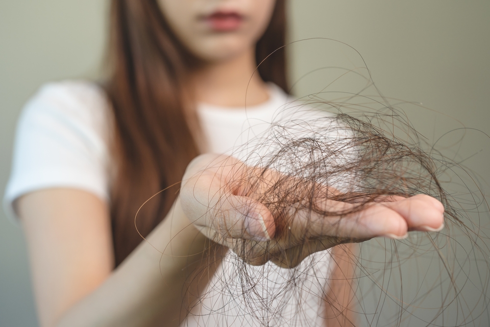 Untangling Questions About Hair Fall Due to Dandruff