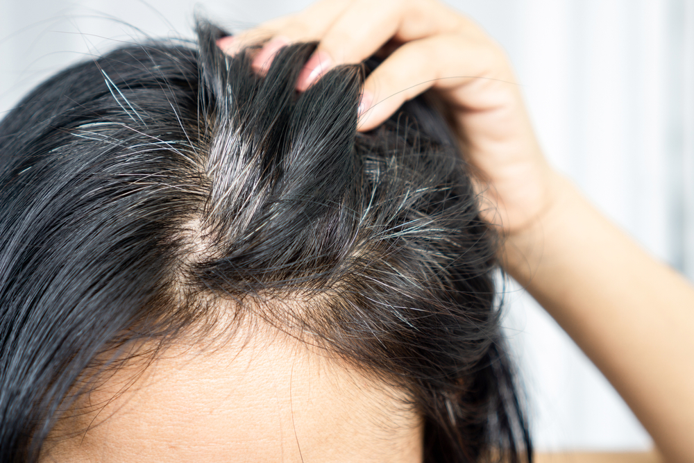 Can You Reverse Graying Hair? Tips to Retain Your Natural Color