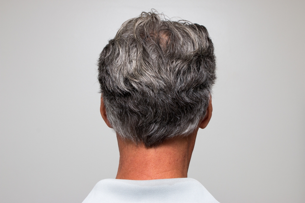 Can You Prevent Your Hair from Turning Gray? Here’s What You Need to Know