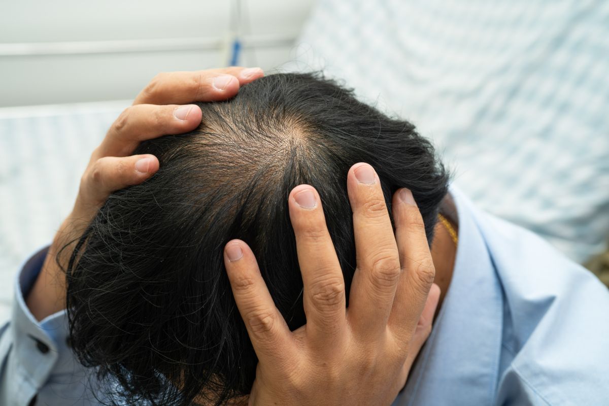 A Guide to Hair Regrowth Treatment
