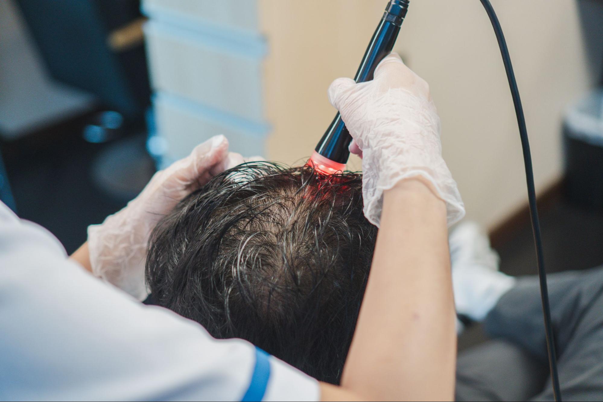 5 Hair Care and Scalp Treatments for Healthy Hair