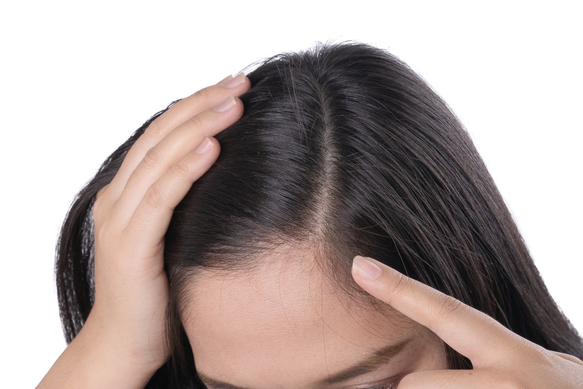 Scalp 101: 5 Effective Thinning Hair Solutions