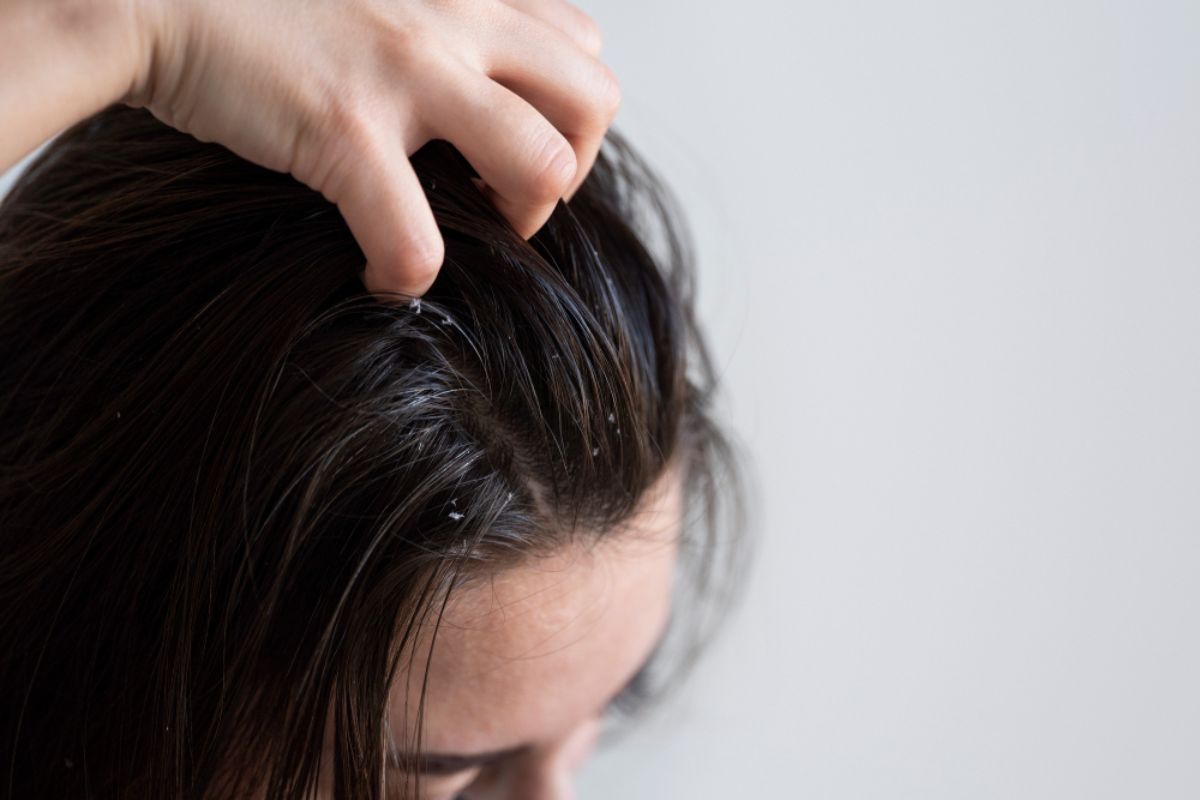How to Choose the Best Hair Restoration Treatment for Your Hair Type