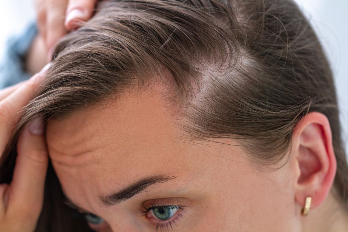 Where to Find a Hair Transplant for a Receding Hairline?