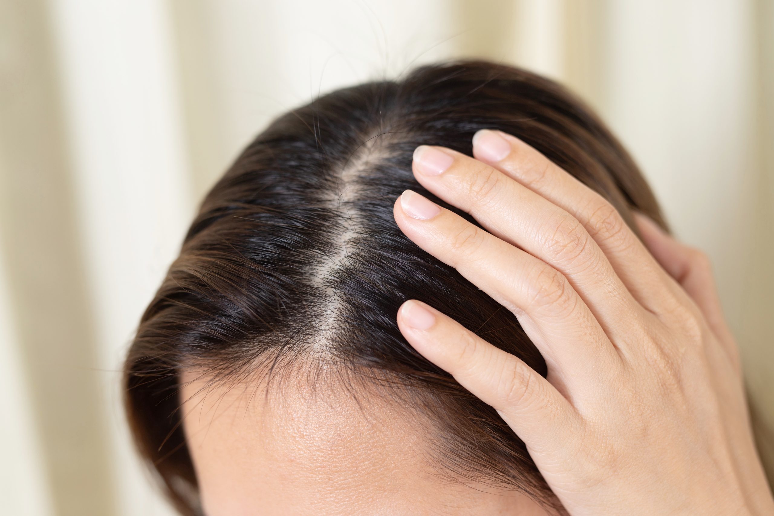 Everyday Habits That Help Reverse Thinning Hair in Females