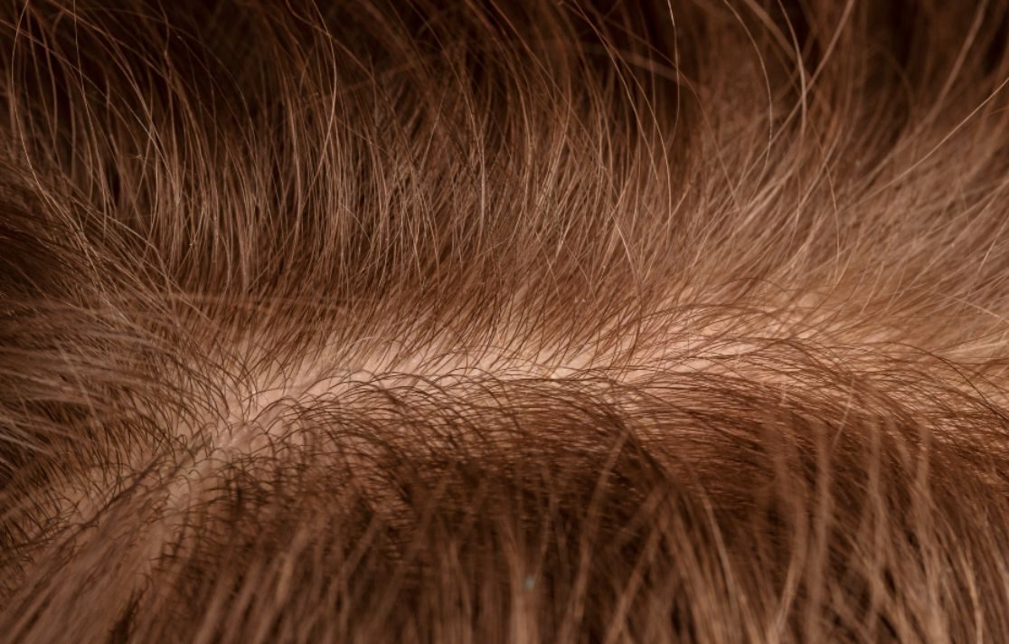 Everything You Need to Know About Hair Follicle Regeneration