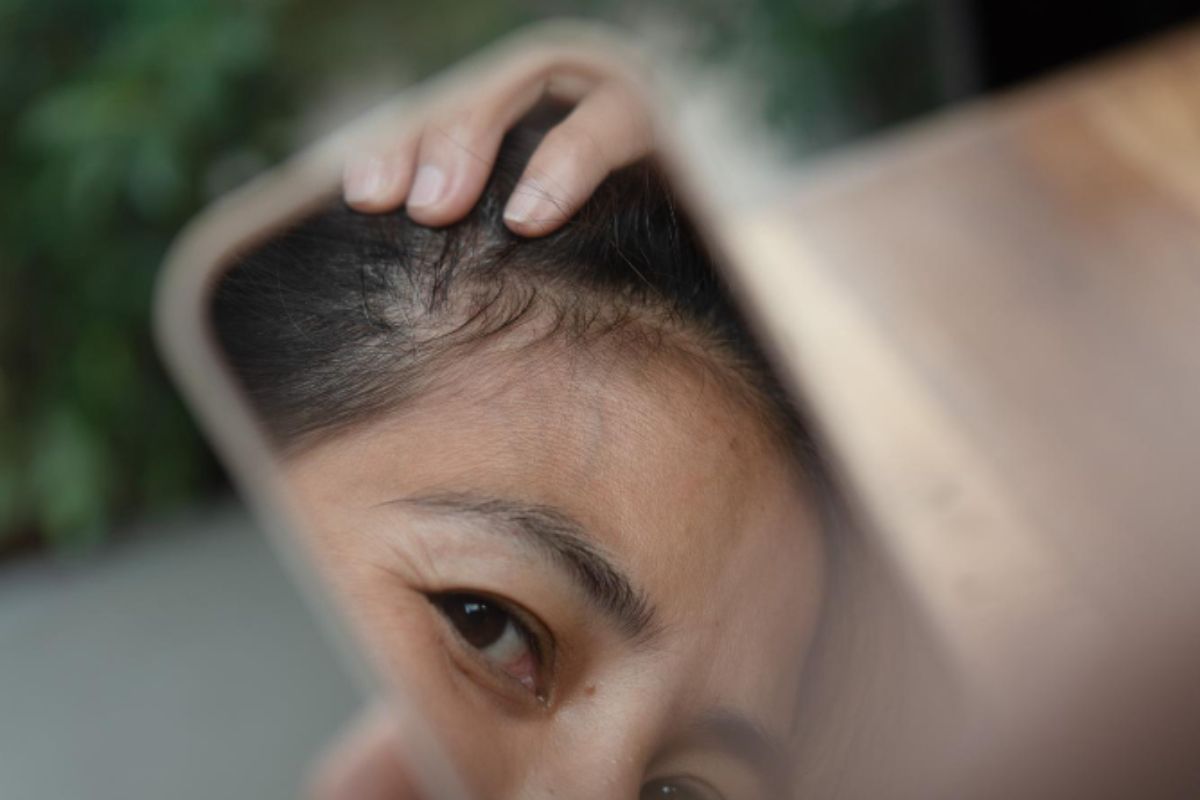 6 Early Warnings You Need Thinning Hair Solutions