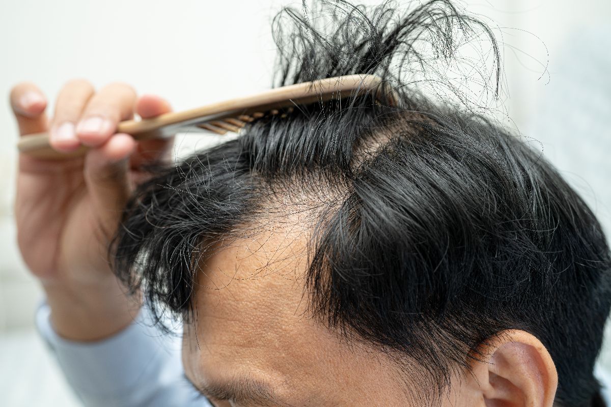Mistakes to Avoid During Hair Loss Recovery
