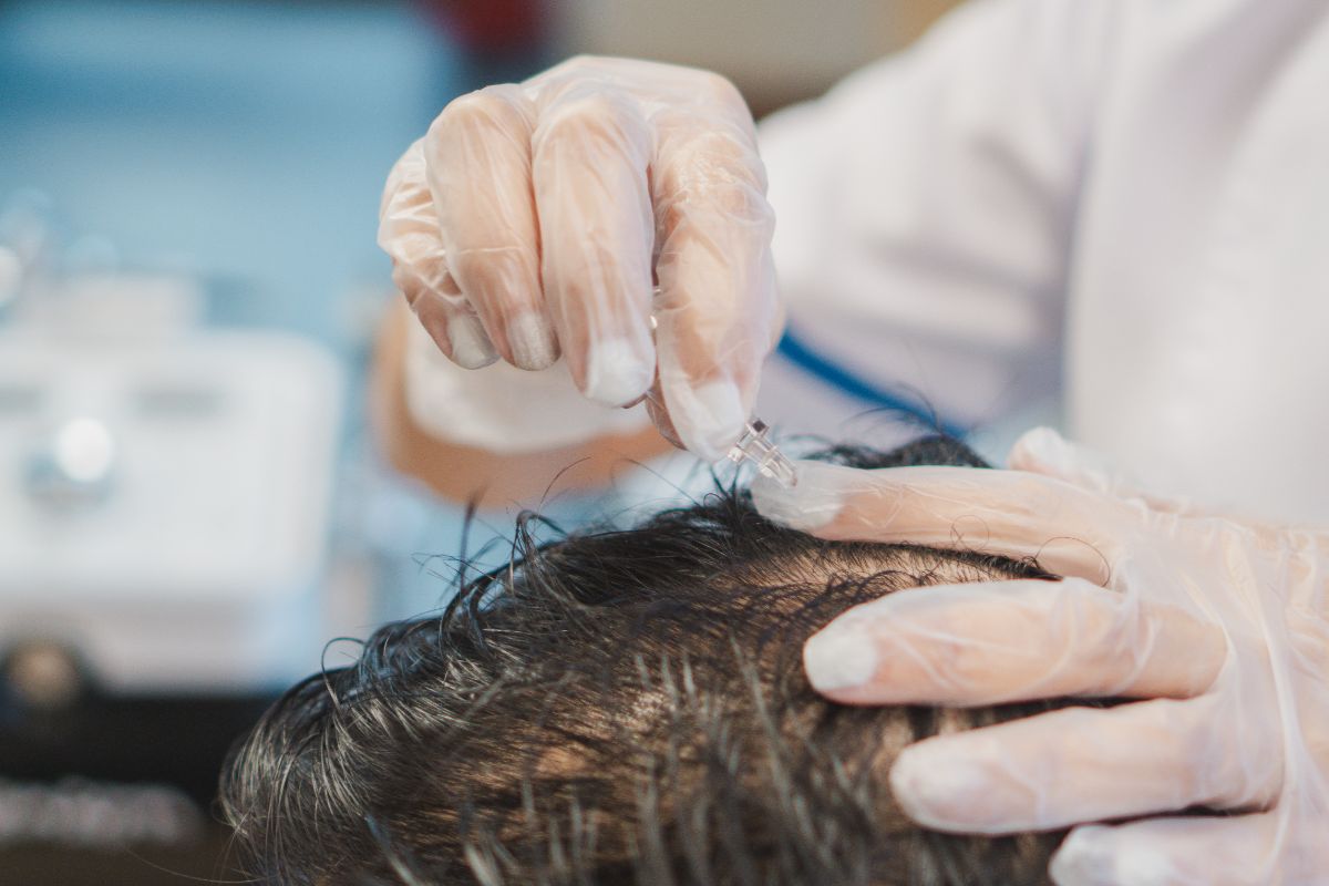 How Lack of Sleep Cause Hair Loss