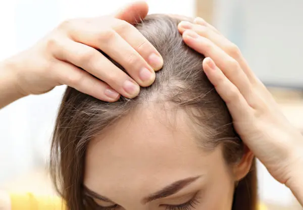 Hair Transplant