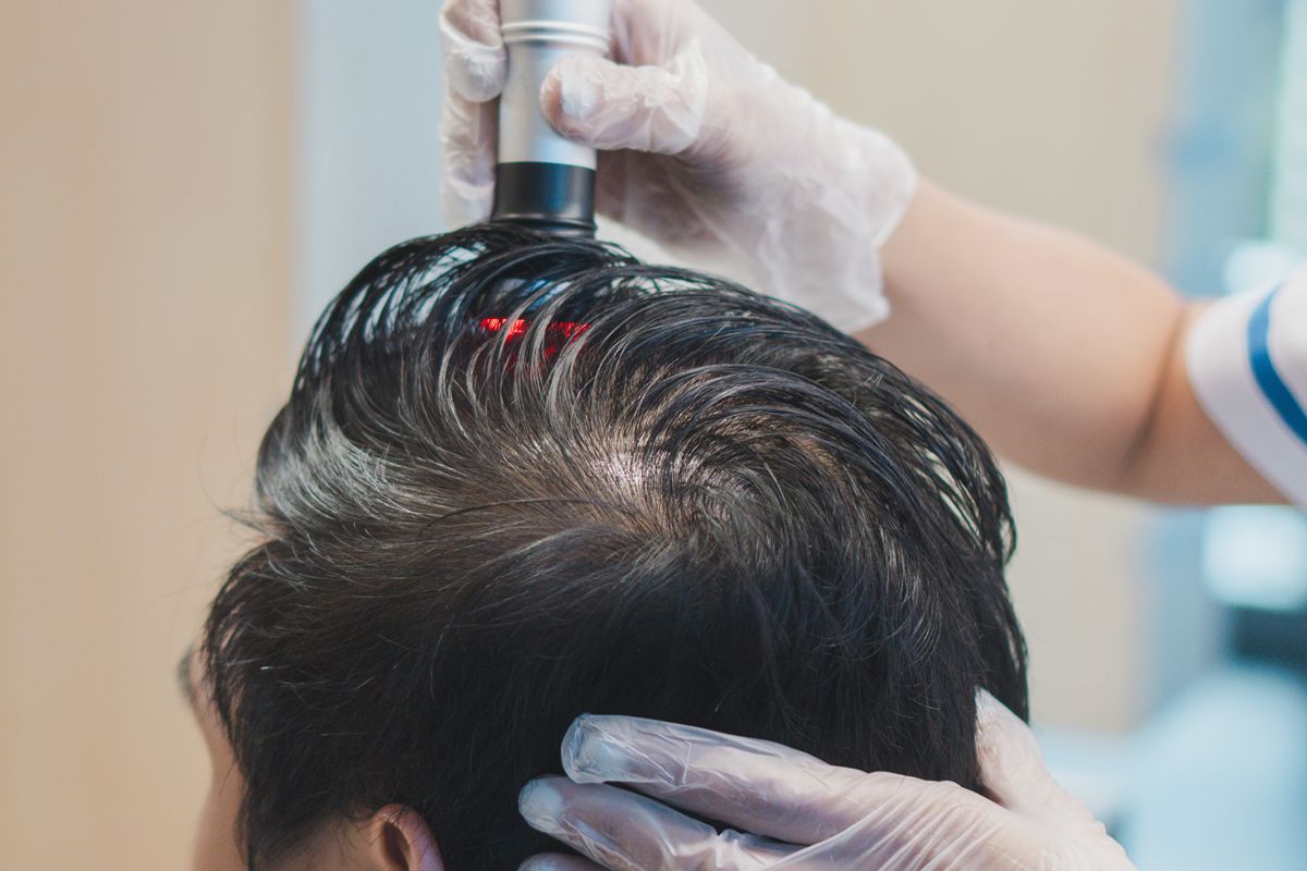 Why Scalp Care Is the First Step in Hair Restoration