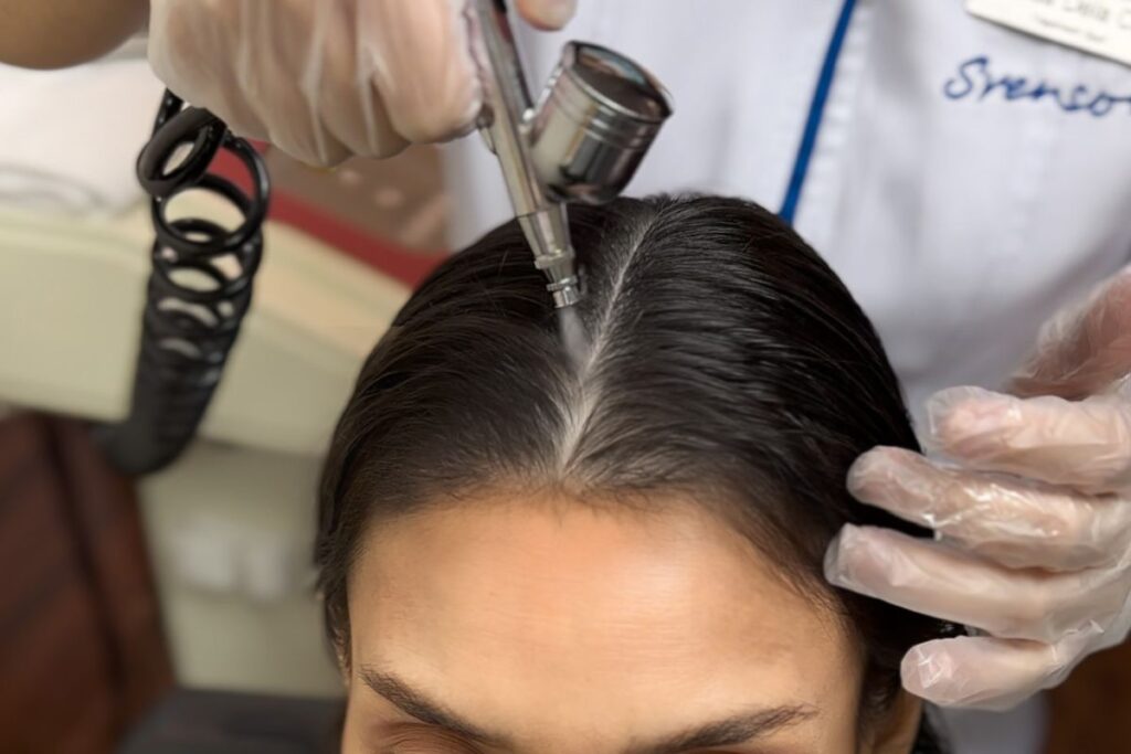 Scalp Corrective Treatment