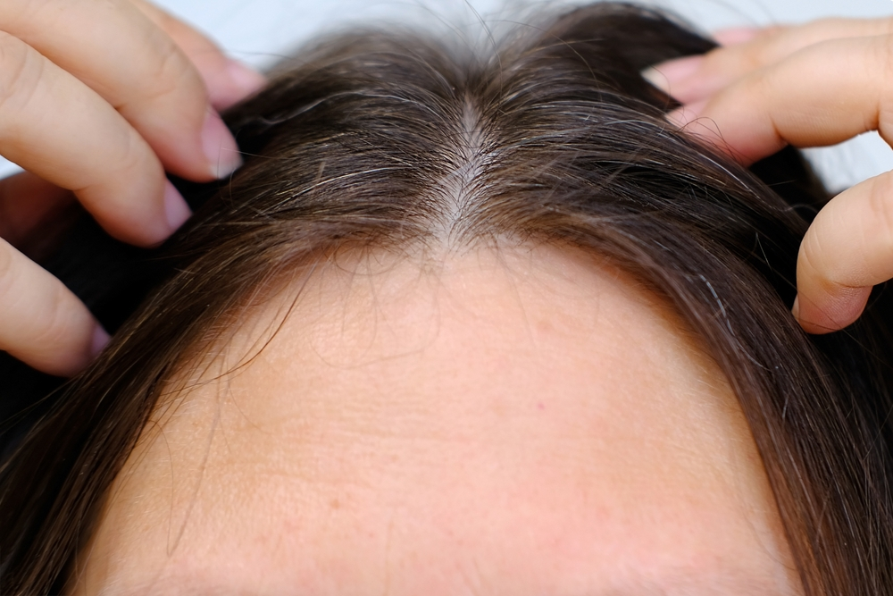 Seeing Silver Strands? Unveiling the Causes of Early Gray Hair