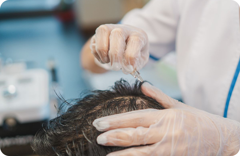 Hair Restoration Treatments Available at Svenson