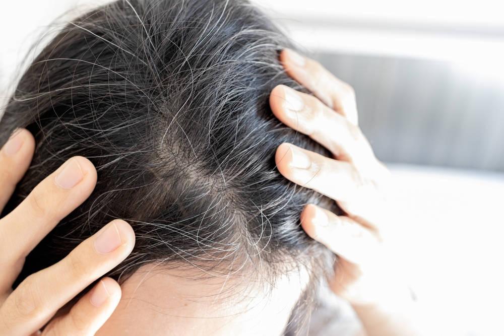 Reasons for White Hair: Some Facts You Should Know