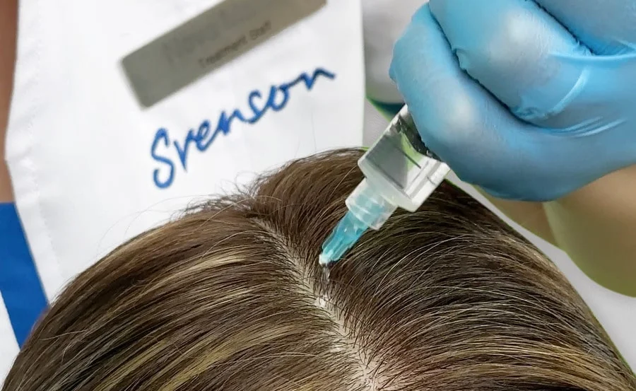What are Exosomes and how do they help in hair loss? Svenson explains